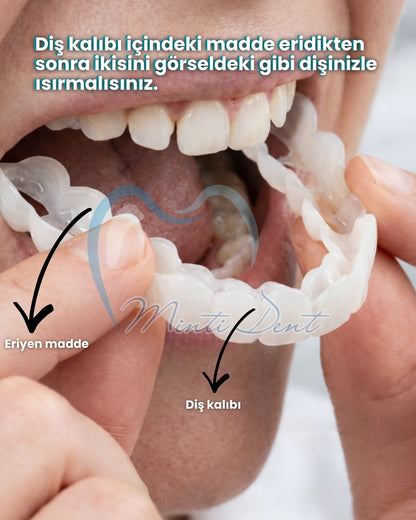 Mintident Takma Diş