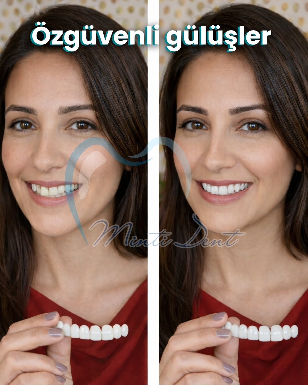 Mintident Takma Diş